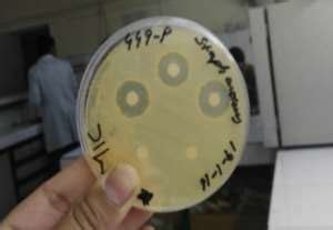 Image result for Mic Disc Diffusion Method