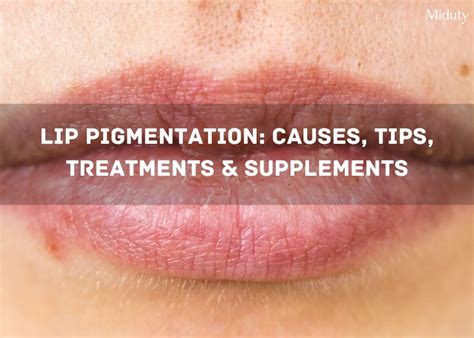Lip Pigmentation: Causes, Tips, Treatments & Supplements - Miduty