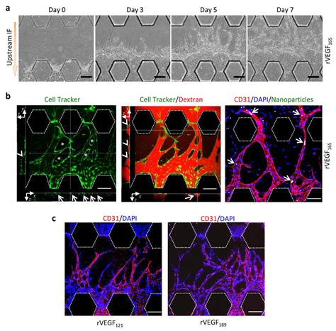 Angiogenesis and Functional Vessel Formation Induced by Interstitial ...