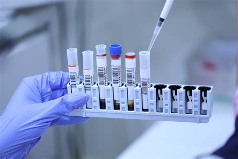 KANNAN DIAGNOSTIC CENTRE | PATHOLOGY LAB | MYSORE