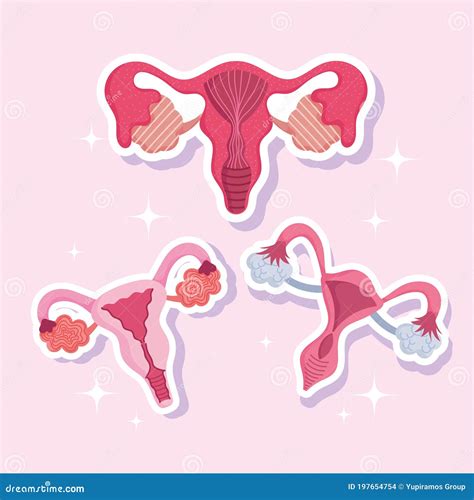 Female Human Reproductive System, Anatomy Gynecology Women, Set Uterus Stock Vector ...