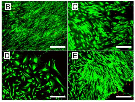 Innovative Use of Gallic Acid as a Crosslinking Agent for Gelatin: A ...