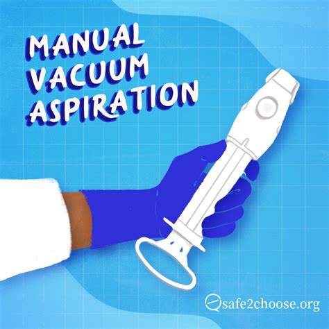 Manual Vacuum Aspiration Abortion
