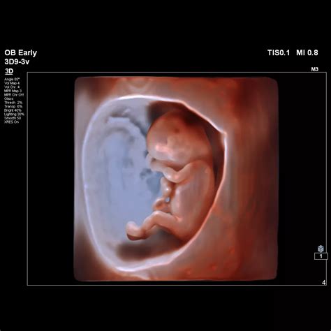 TrueVue Pro - Philips