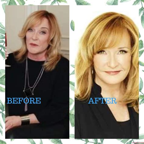 Vanna White Plastic Surgery Photos [Before & After] - Surgery4