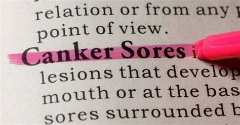 Are Canker Sores Contagious? Ultimate Guide [year]