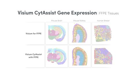 Spatial Transcriptomic Map 的图像结果