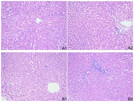 Interferon-alpha Induces High Expression of APOBEC3G and STAT-1 in ...