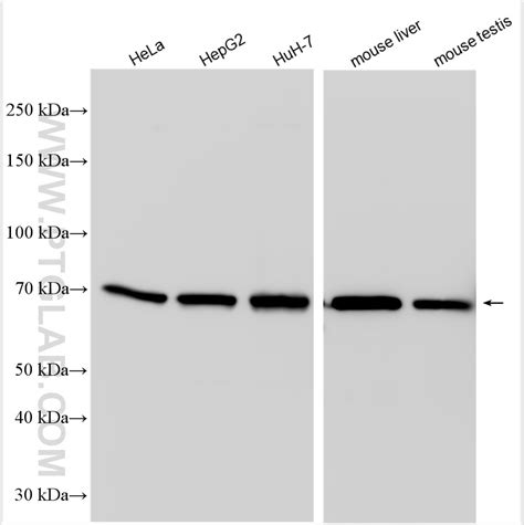 RGS14 antibody (16258-1-AP) | Proteintech