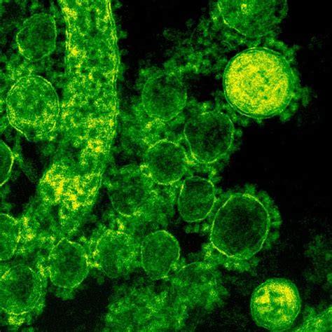 Vaginal Discharge Color Guide: What to Know & When to Worry