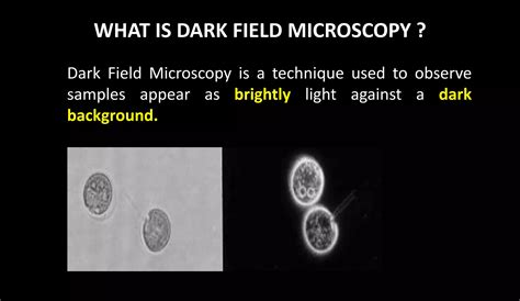 Dark field and Phase Contrast Microscope | PPTX