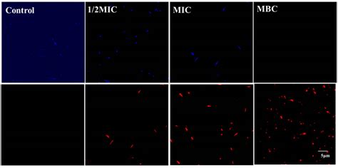 Juglone Inactivates Pseudomonas aeruginosa through Cell Membrane Damage ...