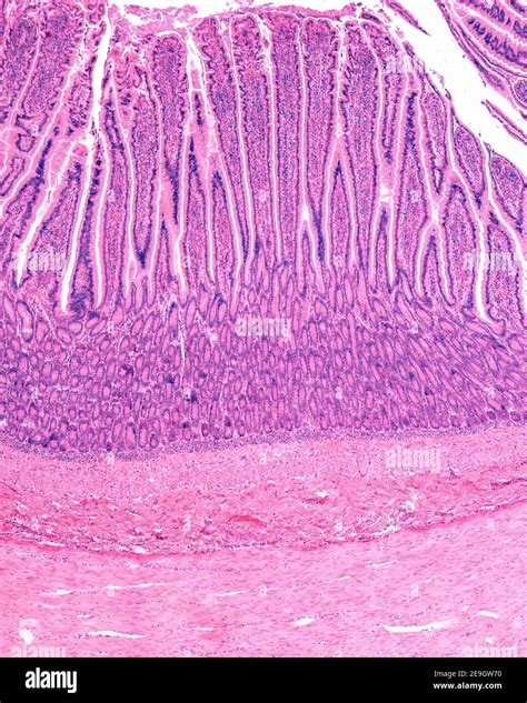 Layers of the small intestine wall showing, from top to bottom: mucosa layer with villi and ...