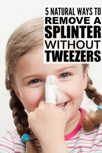 Image result for Remove Splinter