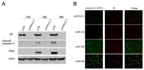 Non-Structural Protein 2B of Human Rhinovirus 16 Activates Both PERK ...