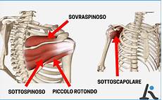 dolore alla gabbia toracica schiena tendinopatia della spalla sovraspinato sottospinato 3 dolore alla gabbia toracica schiena tendinopatia della spalla sovraspinato sottospinato 3