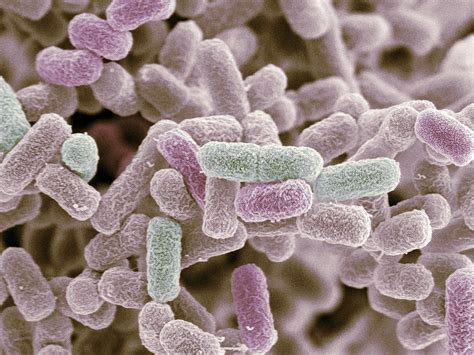 Free photo: Escherichia coli - Microbiology, Inspection, Lab - Free Download - Jooinn