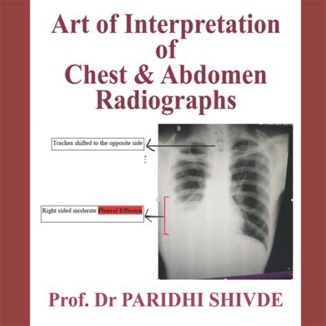 Buy ART OF INTERPRETATION OF CHEST AND ABDOMEN RADIOGRAPHS Online at ...