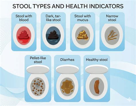 Colon Cancer Stool Pictures