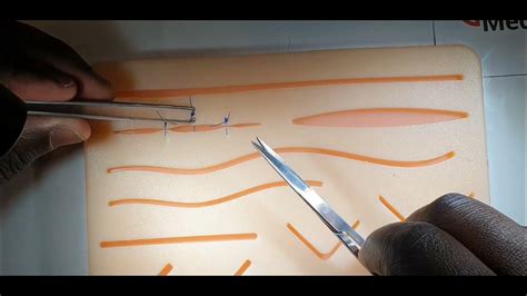 Removing Sutures Step by Step 的图像结果