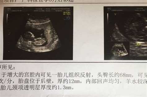 孕妇孕检检查素材图片免费下载-千库网