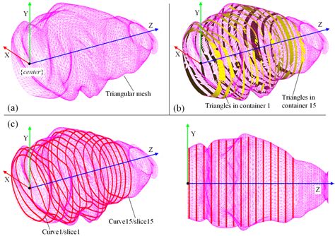 Preoperative Planning Framework for Robot-Assisted Dental Implant ...