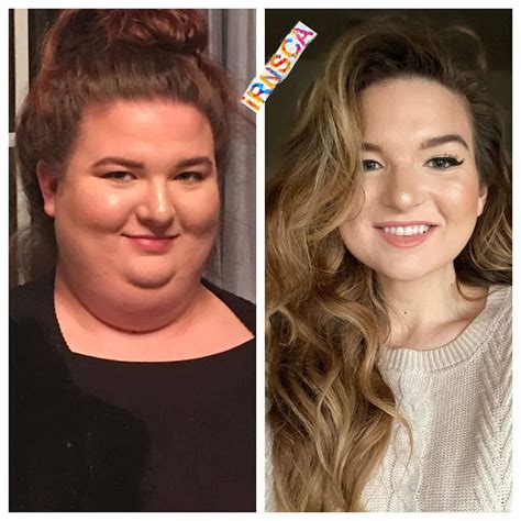 128 amazing before after pics reveal how weight loss changes your face – Artofit