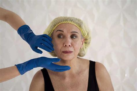 Why did some people look worse after cosmetic surgery?