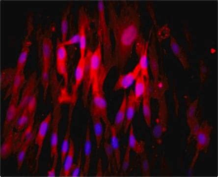 Anti-CD73 Antibody, clone AA60-E3-3 clone AA60-E3-3, from mouse | Sigma ...