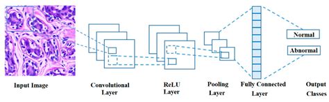 Optimizing the Performance of Breast Cancer Classification by Employing ...