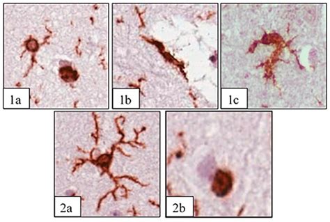 Morphology of Cortical Microglia in the Hyperacute Phase of ...