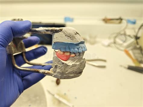 Image result for How to Take Study Models with Plaster Lab