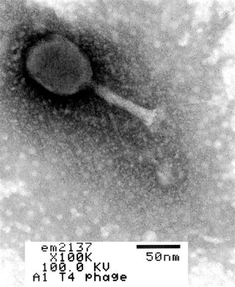 Enterobacteria phage T4 (Phage tail fibers) - CIL:41124 - DocCheck