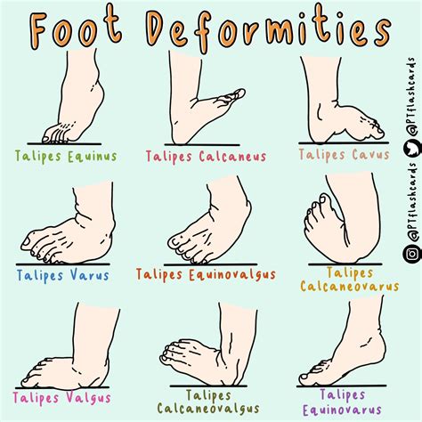 Foot Disorders