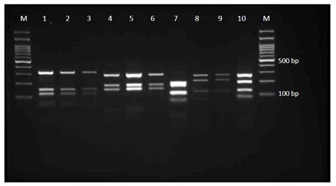 Diversity of Geophilic Dermatophytes Species in the Soils of Iran; The ...