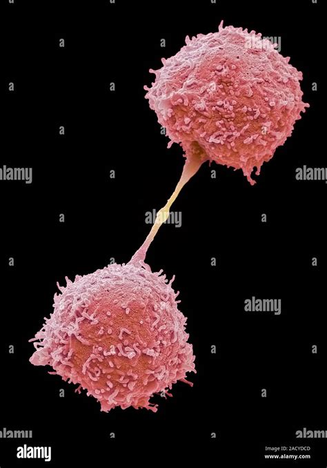 Image result for Lymphocytes Microscopic View