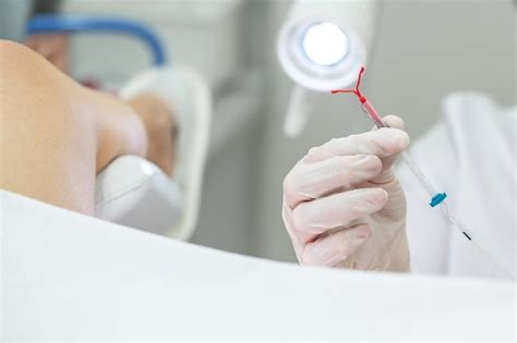 Permasalahan Umum pada Pasien dengan Kontrasepsi IUD - Alomedika