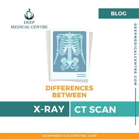 7 Differences Between X Ray And CT Scan - Deep Medical Centre