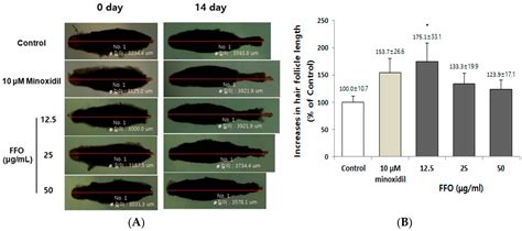 Mackerel-Derived Fermented Fish Oil Promotes Hair Growth by Anagen ...