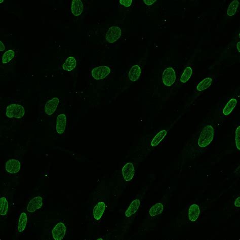 Image result for Measuring Fluorescence Intensity ImageJ