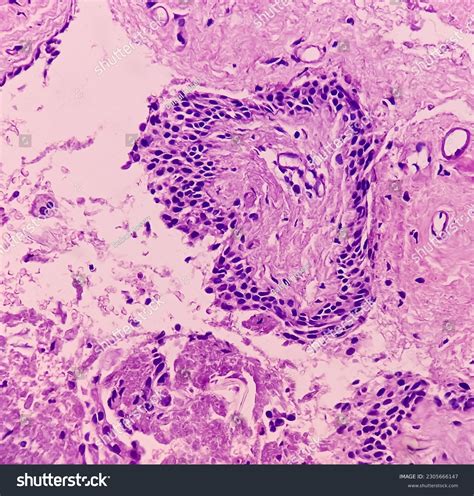 Skenes Gland Histology