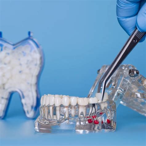 Same Day Crowns Near Me