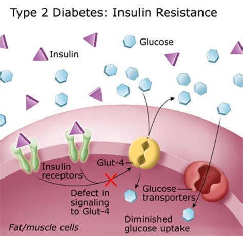Non Insulin Dependent Diabetes Mellitus
