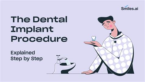The Dental Implant Procedure – Explained Step by Step
