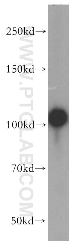 MPV17 antibody (10310-1-AP) | Proteintech