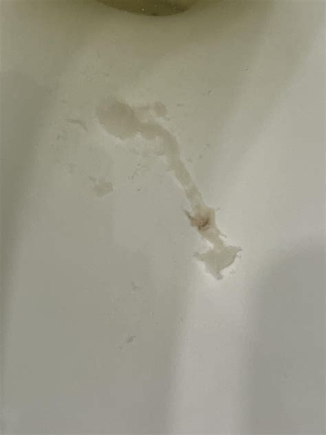 White jelly in stool : r/poop
