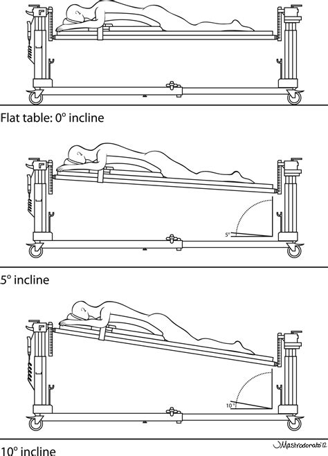 Effect of the degree of reverse Trendelenburg position on intraocular pressure during prone ...