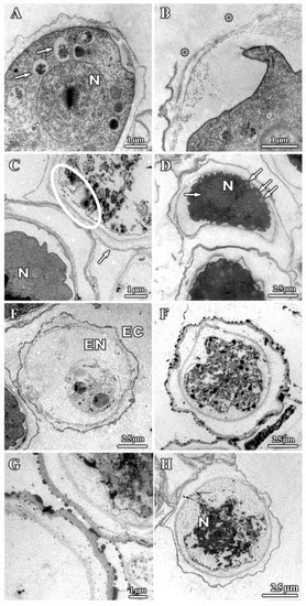 Ultrastructural Study of Acanthamoeba polyphaga Trophozoites and Cysts ...