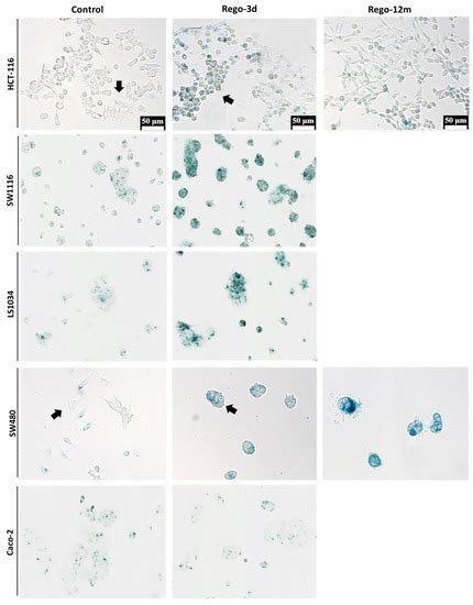 Cells | Special Issue : Innovative Drug Treatment of Cancer Cells