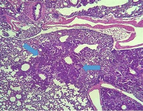 Tissue Processing in Histopathology 的图像结果